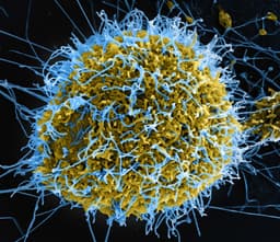 Ebola pandemic in 2026?